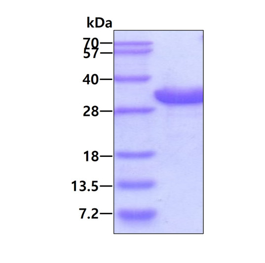 SDS-PAGE gel of recombinant human IGFBP-1 protein under reducing conditions stained with Coomassie blue