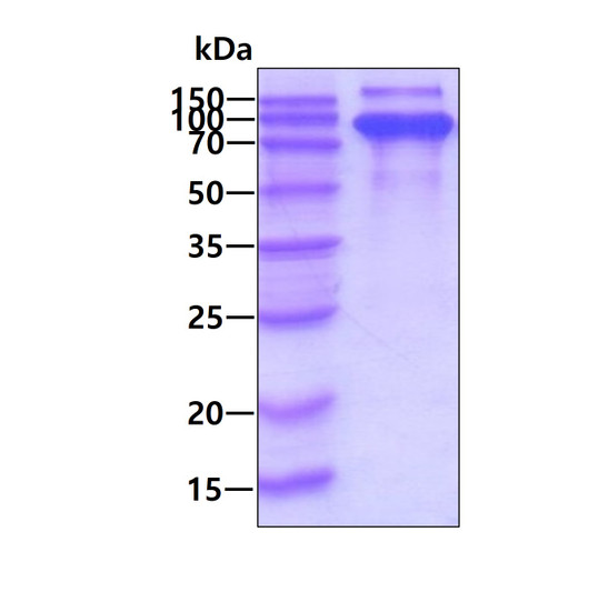 SDS-PAGE gel of recombinant rat MMP-9 protein under reducing conditions stained with Coomassie blue