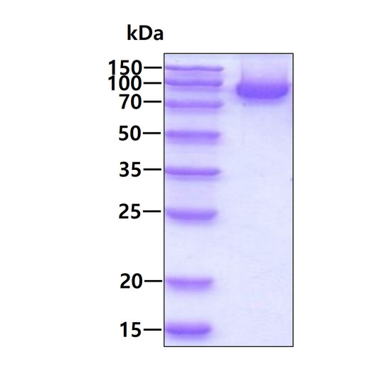 SDS-PAGE of recombinant human CD4 protein 3µg under reducing conditions Coomassie blue stain