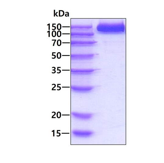 SDS-PAGE gel of recombinant human CD26 DPP4 protein under reducing conditions stained with Coomassie blue