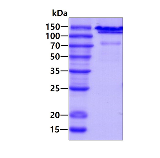 SDS-PAGE gel of recombinant human APP Protease Nexin II protein under reducing conditions