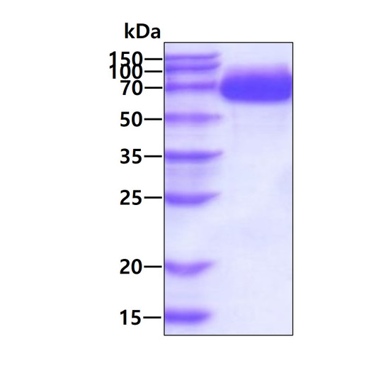 SDS-PAGE gel of recombinant human Alkaline Phosphatase ALPL protein under reducing conditions