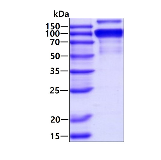 Recombinant mouse MMP-9 protein SDS-PAGE gel under reducing conditions stained with Coomassie blue