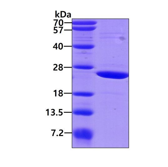 SDS-PAGE gel of recombinant human Crystallin alpha B CRYAB protein under reducing conditions