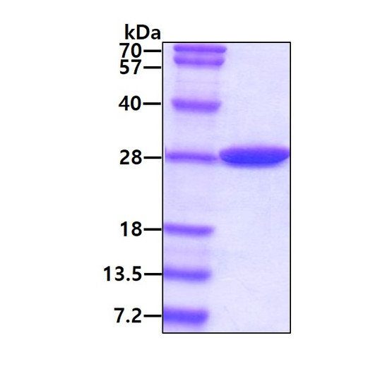 SDS-PAGE gel of recombinant E.coli Carbonic anhydrase 2 protein 3 µg Coomassie blue stain