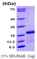 SDS-PAGE gel showing recombinant human Complexin-1 protein 3ug under reducing conditions with Coomassie blue stain