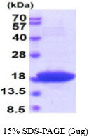 SDS-PAGE gel of recombinant E.coli DnaK 508-638aa protein under reducing conditions