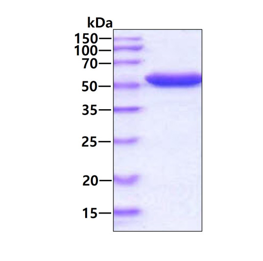 SDS-PAGE gel showing recombinant E.coli G6PD protein 3µg under reducing conditions with Coomassie blue staining