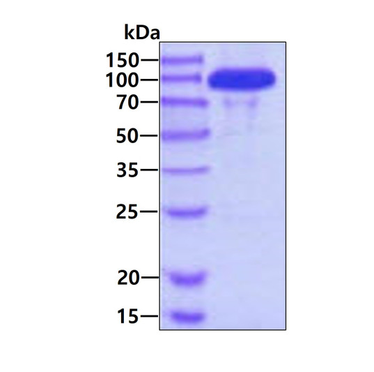 Recombinant human Hexokinase 3 protein SDS-PAGE gel 3µg reducing conditions Coomassie blue stain