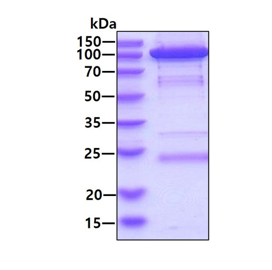 SDS-PAGE of recombinant human Hexokinase 1 protein 3µg reducing conditions Coomassie blue stain