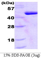 SDS-PAGE gel of recombinant human PDK1 protein 3µg under reducing conditions Coomassie stain