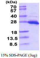 SDS-PAGE gel of recombinant human PGP9.5 UCHL1 protein 3µg reducing conditions Coomassie blue stain