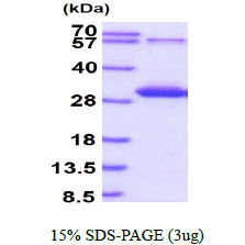 SDS-PAGE of recombinant human PP2C gamma PPM1G protein 3µg under reducing conditions Coomassie stain