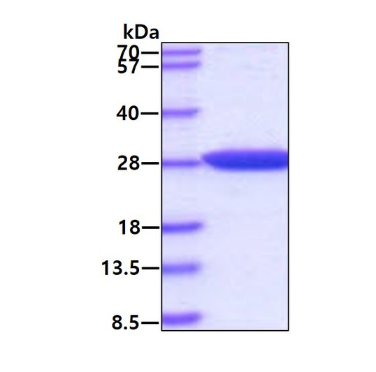 SDS-PAGE gel of recombinant human DJ-1 PARK7 protein under reducing conditions