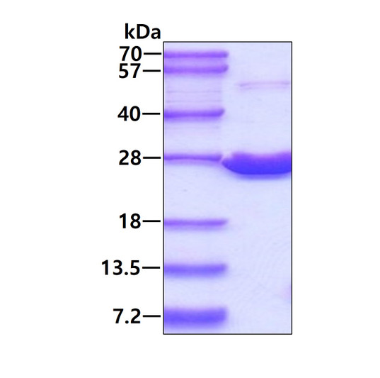 Recombinant human PRDX1 protein SDS-PAGE under reducing conditions Coomassie stain