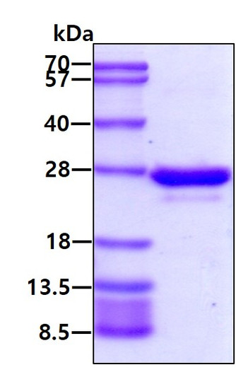 SDS-PAGE of recombinant human RAB5A protein under reducing conditions