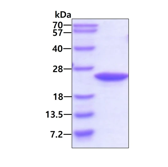 SDS-PAGE gel showing recombinant human RBP4 protein 3µg under reducing conditions Coomassie blue stain