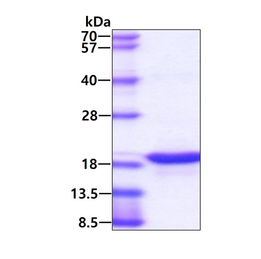 SDS-PAGE gel of recombinant human TRAIL TNFSF10 protein under reducing conditions