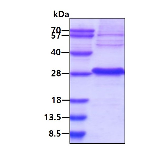 Recombinant human VHL protein Cat No. STJP019804 antibody reagent