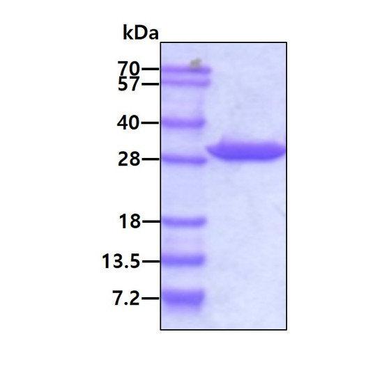 SDS-PAGE gel of recombinant human 14-3-3 gamma protein under reducing conditions stained with Coomassie blue