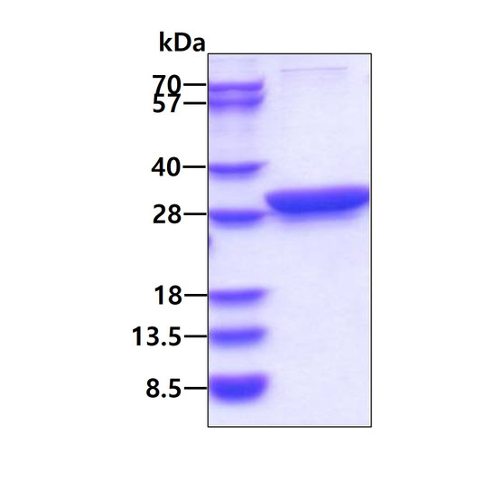 SDS-PAGE of recombinant human 14-3-3 theta protein under reducing conditions