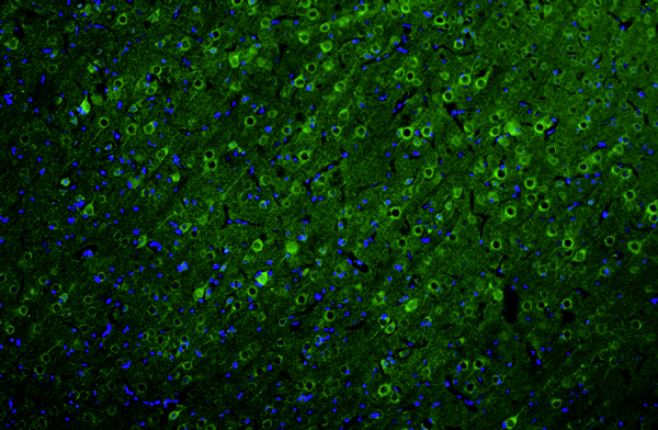 IHC staining rat brain cerebral cortex neurons using Ankyrin-G antibody with DAPI counterstain STJA0040435