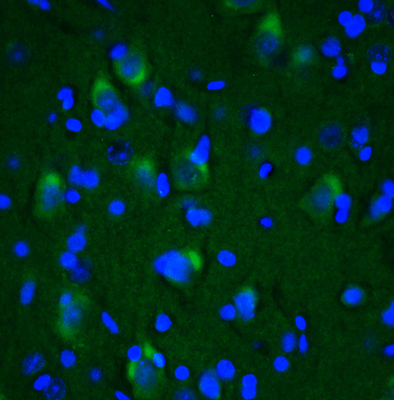 IHC staining rat brain cerebral cortex using anti-LRRK2 antibody green fluorescence STJA0040460