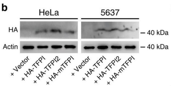 Western blot using Actin as loading control for TFPI protein expression in HeLa cells STJA0040577