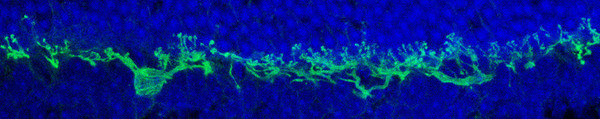 IHC staining mouse retinal horizontal cell using Anti-V5 antibody with DAPI counterstain STJA0040595