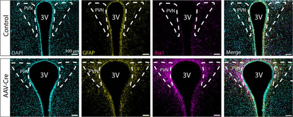 IHC staining with Iba1 expression in mouse paraventricular nucleus hypothalamus STJA0040604