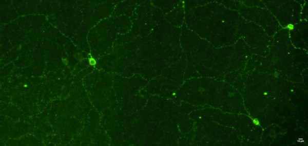 ICC staining melanopsin in mouse retinal tissue using chicken antibody STJA0040614