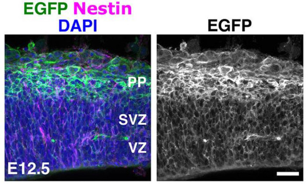 IHC staining E125 mouse cortex sections using Nestin antibody in magenta with DAPI counterstain STJA0040619