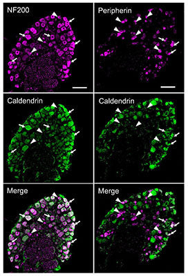 IHC confocal micrograph mouse DRG cryosection using antibody NF200 and caldendrin staining STJA0040622