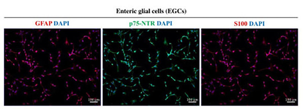 ICC staining mouse Schwann cells Mpz detection using antibody red fluorescence STJA0040631
