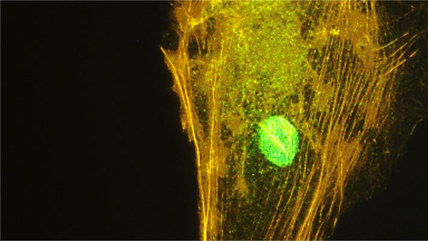 ICC staining NTERA2 cells using antibody nuclear localization in green STJA0040635