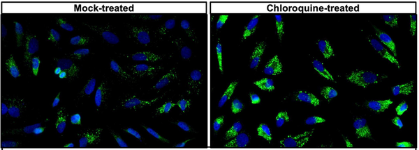 ICC staining HeLa cells using antibody autophagosome localization with DAPI nuclear stain STJA0040636