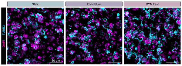 ICC fluorescence hNPCs with DAPI-labeled nuclei and TUBB3 neuritic extensions using antibody STJA0040643