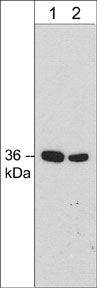 Western blot using anti-Annexin A2 antibody on rat PC12 cell lysate at two dilutions STJA0041051