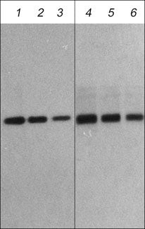 Western blot analysis human recombinant Atrogin-1 using antibody at multiple dilutions STJA0041052