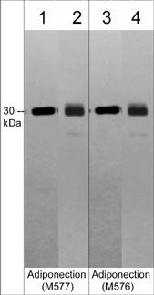 Western blot mouse adipose tissue and human adiponectin using antibody STJA0041061