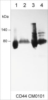 ICC staining CD44 in human A431 cells using antibody with DyLight 594 detection STJA0041088