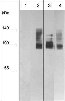 Western blot human MDA-MB-231 lysates using anti-CD44 antibody STJA0041134