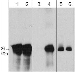 WB analysis A431 cells caveolin-1 detection with and without pervanadate stimulation STJA0041155