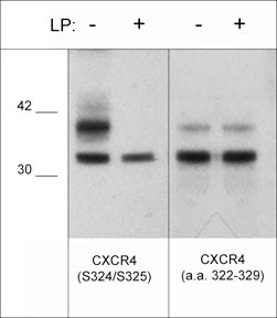 Western blot CXCR4 phosphorylation in Jurkat cells with phosphatase treatment comparison STJA0041166