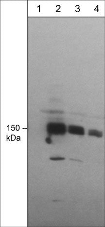 Western blot mDia1 expression in Jurkat cells using antibody at various dilutions STJA0041180