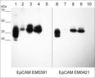 Western blot EpCAM detection in cancer cell lysates using mouse monoclonal antibody STJA0041185
