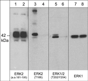 Western blot A431 cells ERK2 phosphorylation detection using antibody STJA0041208