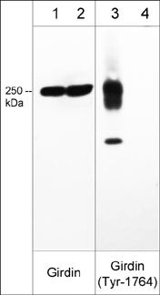 Western blot Girdin phosphorylation in pervanadate-treated A431 cell lysates STJA0041232