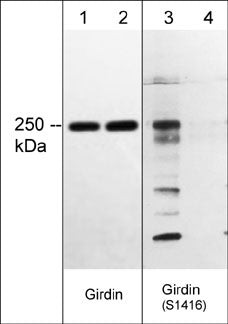 Western blot A431 cell lysates Girdin Ser-1416 phosphorylation using antibody STJA0041238