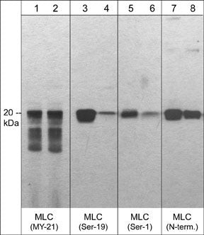 Western blot analysis C2C12 cells using anti-MLC antibodies with phosphatase treatment comparison STJA0041275
